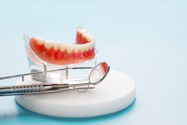 Dental Inlays and Onlays in Orange, TX
