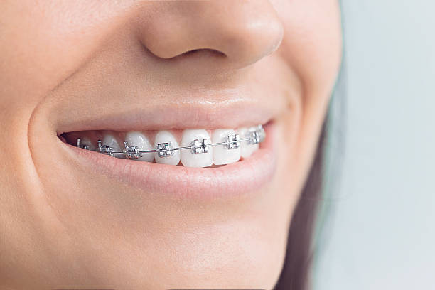 Full Mouth Reconstruction in Orange, TX